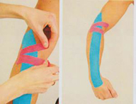 Tape