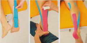 Tape